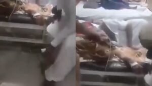 Patient Given Oxygen with Bicycle Pump? Umerkot Hospital Denies Viral Video